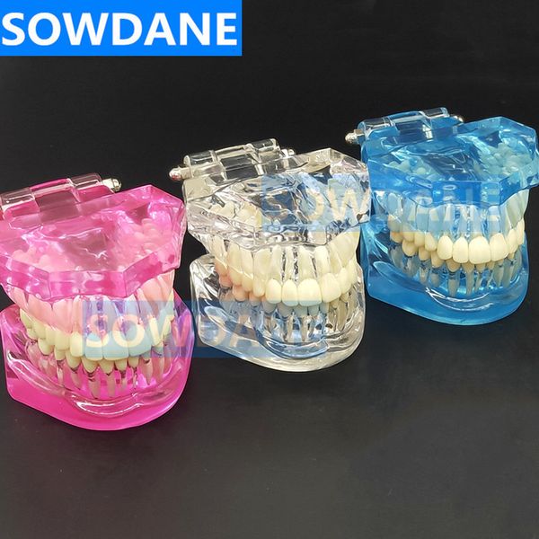 Autre hygiène bucco-dentaire 1pc modèle de dent standard dentaire modèle orthodontique pour la communication du patient étude dentaire modèle de clinique outil dents inamovibles 230524