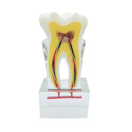 Andere orale hygiëne 1 stks Tandheelkundige zenuwanatomie Leer tandmodel Zes keer pathologisch tandtandentanden Anatomie Model voor tandheelkundig geschenk 230815