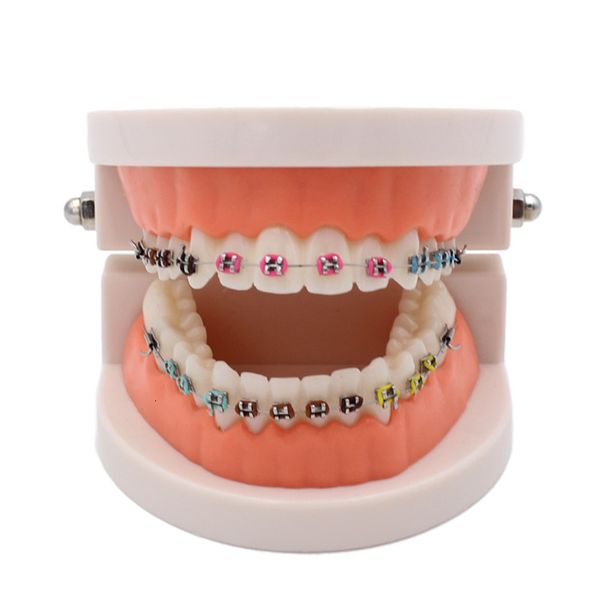 Autre hygiène bucco-dentaire Un modèle orthodontique pour l'étude de l'enseignement orthodontique Modèles orthodontiques pour la dentisterie médicale Soins bucco-dentaires et produits dentaires 230802
