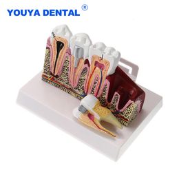 Autre modèle de structure anatomique d'hygiène bucco-dentaire Modèle d'enseignement des dents dentaires dentaires standard Dentiste complet Démonstration d'étudiant dentaire 230617
