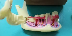 Other Oral Hygiene Dental Endodontic Treatment Model Anatomy of gums Dental Study Teach Teeth Model 230524