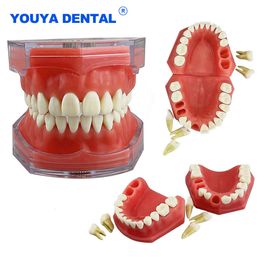 Overig Mondhygiëne Tandheelkundig model Verwijderbare tanden Model Afneembaar implantaat Zacht tandvlees Model Tandarts Onderwijs Onderzoek Tandheelkunde TYPODONT Model 230720