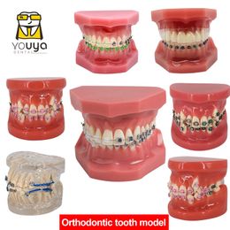 Andere mondhygiëne tandheelkundig model met beugelt tandheelkunde materialen orthodontische modellen Gum Tandtanden Model voor het bestuderen van onderwijs Patiënteducatie 230815