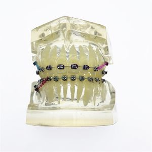 Autre modèle de dents orthodontiques dentaires d'hygiène buccale malocclusion transparente avec supports 230704