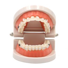 Andere orale hygiëne tandheelkundige orthodontisch behandelingsmodel met ortho metaal keramische beugel boogdraad buccale buis ligatuur banden tandarts gereedschap tandartslab 230524