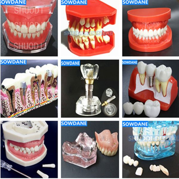 Autre hygiène bucco-dentaire étude dentaire modèle d'enseignement implant dentaire modèle standard dents amovibles ADULTE enfant modèle TYPODONT modèle de communication dentiste 230524