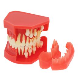 Otro modelo de enseñanza dental de higiene oral niños Niños de dientes permanentes Typoding Typodont Dentos constantes Grow Reples