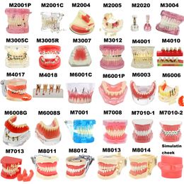 Otro modelo de dientes dentales de higiene bucal Modelos de enseñanza dental Modelo de implante Modelo de odontología removible Dientes para entrenamiento Estudiar Educación del paciente 230720