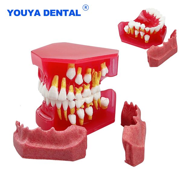 Autre modèle de dent dentaire d'hygiène bucco-dentaire enfants dents permanentes primaires modèle de dents en résine à feuilles caduques alternatives pour étudier l'enseignement de la communication 230516