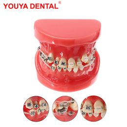 Andere orale hygiëne tandarts tandheelkundig orthodontisch behandelingsmodel met keramische metalen beugel hars orthodontische tanden model ortho tanden onderwijsmodellen 230815