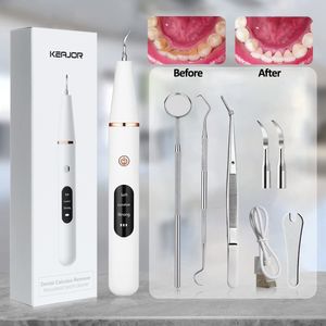 Otra higiene bucal G6 Removedor de cálculo dental ultrasónico Dientes Placa Eliminador de sarro Limpiador de manchas Piedra de dientes eléctrica 230824