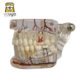 Otros dientes de higiene bucal Reparación neuronal implante dental Modelo patológico Estudiantes Dentistas Comunicación Aprendizaje Aprendizaje Enfermedad Enfermedad 230417