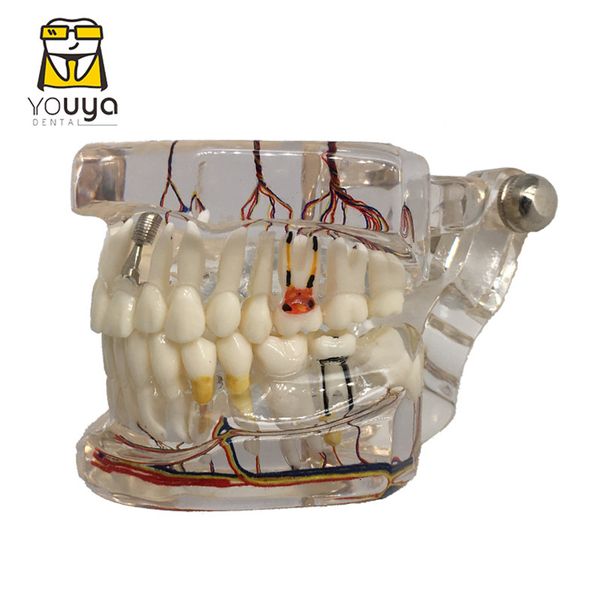 Autre Hygiène de dents buccales Réparation neuronale Réparation dentaire Modèle pathologique Dentiste Étudiants Communication Recherche d'apprentissage Disease Enseignement 230417