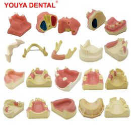 Otras higiene oral Yoya 1pcs modelo dental dental dientes práctica modelo dental implante dental model capacitación muestra de odontología de enseñanza oral 230815