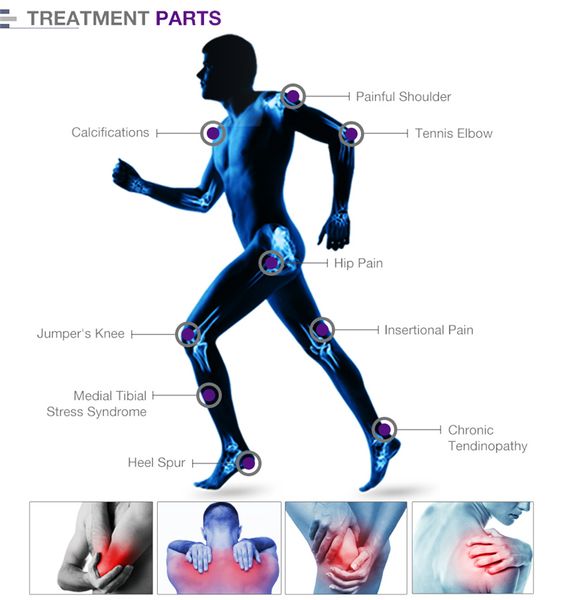 Sistema de terapia de dolor físico 8 Bar 2000000 Shots Alivie la fatiga extracorpórea onda de choque Fisioterapia Instrumento Equipo de masaje de vibración