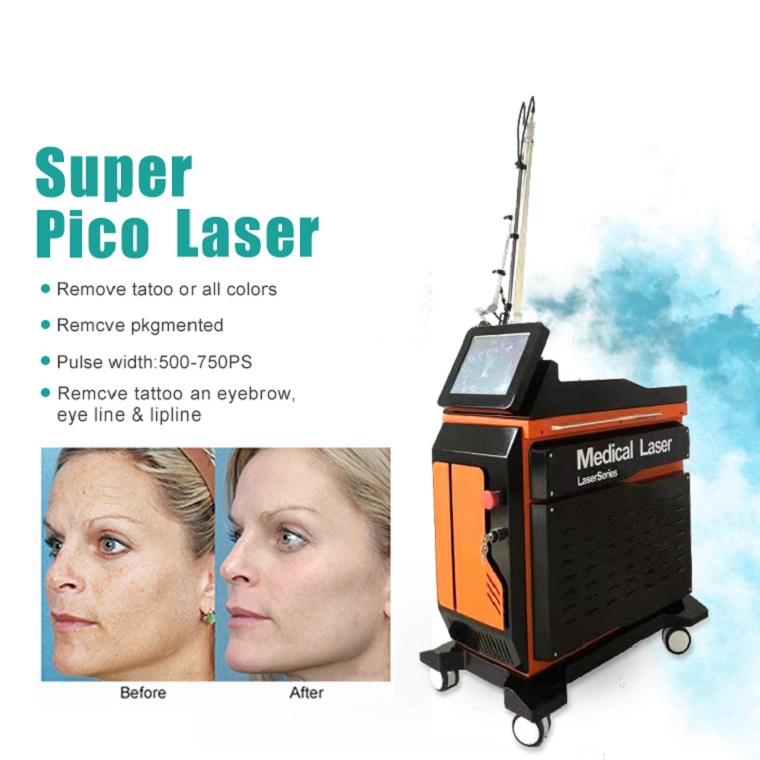 Pikosekundenmaschine Permanente Pigmente Entfernung Pico Second Laser Tattoo entfernen nd yag laser pico laser picosekundengeburtsmark haushaut entfernen Hautverjüngung