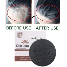 Polygonum Multiflorum Dry Hair Unisexe Shampooing Savon Perte Perte Blanc Turn