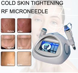Portable Miconeedle RF Face Lift Secret Aqua Gold Fractionnel Radio Fréquence Refjeunnation RF Microoneedle Beauty Machine
