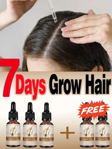 Productos para el crecimiento del cabello, productos de aceite para hombre y mujer, crecimiento rápido, reparación efectiva de la calvicie, tratamiento anticaída hereditaria