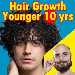 Produits puissants croissance des cheveux pour les hommes femmes cheveux rapides repousse