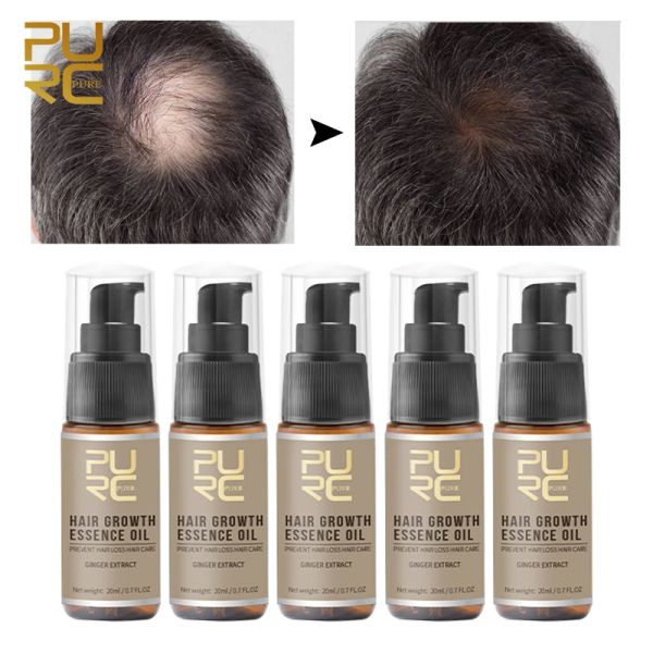 Productos PURC 5 uds aceite para el crecimiento del cabello para adelgazar el cabello Ginseng jengibre prevenir la pérdida de cabello suero tratamientos para el cuero cabelludo cuidado del cabello