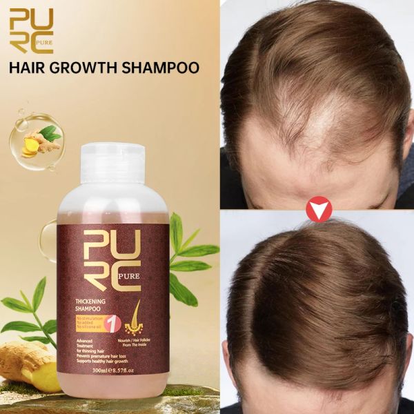 Produits Purc Ginseng Ginger Growth Growth Shampooing and Revitaler Anti-Hair Loss AntiANDRUFF SAUPP TRAITEM