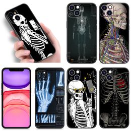 Étui de téléphone des organes humains radiologiques pour Apple iPhone 12 13 Mini 11 14 Pro Xs Max 6S 6 7 8 Plus 5S x XR SE 2020 2022 Couverture noire