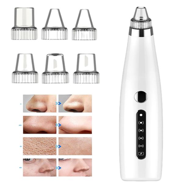 Removedores Removedor de espinillas, Limpiador eléctrico de imperfecciones con succión al vacío, Herramienta para el cuidado facial de salud y belleza, Eliminación de poros, Acné de nariz, Etiqueta de espinillas