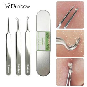 Brainbow 3 pièces pince à points noirs nettoyant pour points noirs dissolvant de points noirs extracteur d'acné comédon outils de soins de la peau du visage