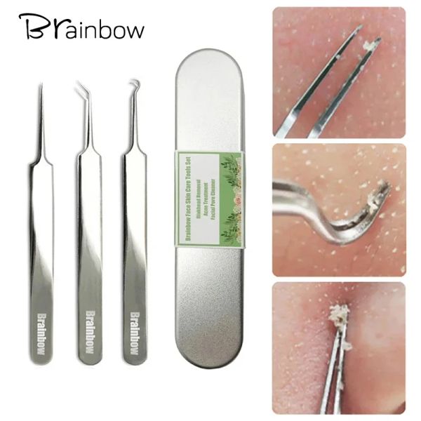 Removedores Brainbow 3 piezas Pinzas para espinillas Limpiador de manchas Eliminadores de imperfecciones Espinillas Comedone Extractor de acné Herramientas para el cuidado de la piel facial