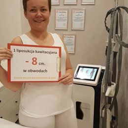 RF Cavitatie Vacuüm Roller Slankmachine Vela Lichaamsvorm Massager Cellulitis Verwijdering Huidverstakking Vet Reductie schoonheidssalon Gebruiksapparatuur met CE goedgekeurd