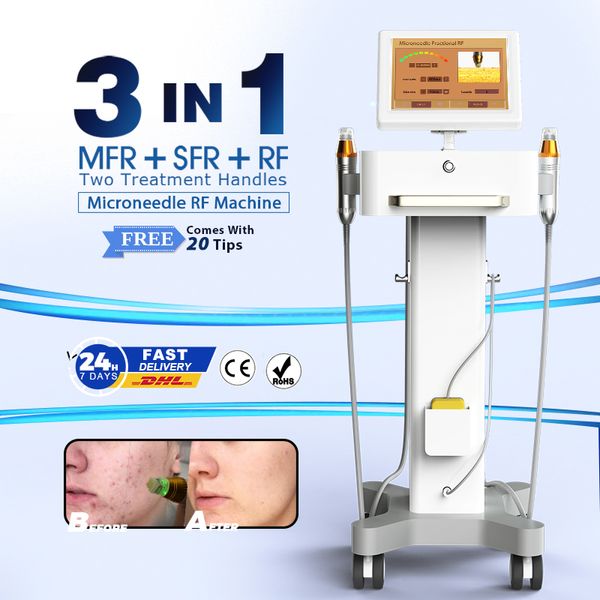 Microneedle RF fractionnaire pour les soins de la peau Enlèvement des cicatrices au laser Traitement de l'acné par radiofréquence Derma Machine anti-rides Microneedling RF