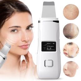 Scrubber RUBYONLY Ultrasone huidscrubber LED-scherm Diepe gezichtsreinigingsmachine Verwijder vuil mee-eter Verminder gezichtsbleken Lifting