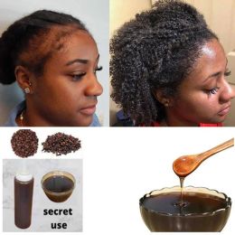 Shampooconditionneur africa femmes traction alopécie traitement propice de croissance des cheveux pour hommes chebe poudre shampooing chair perte de chair