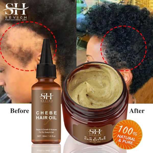 Shampoocondicionista Conjunto de crecimiento de cabello rápido Chebe tracción alopecia mascarilla para el cabello contra la ruptura crecimiento de la caída del cabello