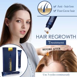 Shampooconditionor puissant les cheveux repousser la perte de cheveux sérique favorisent la réparation de liquide nourrir les racines de cheveux reprowth contrôle les soins de cheveux à la chair de cheveux