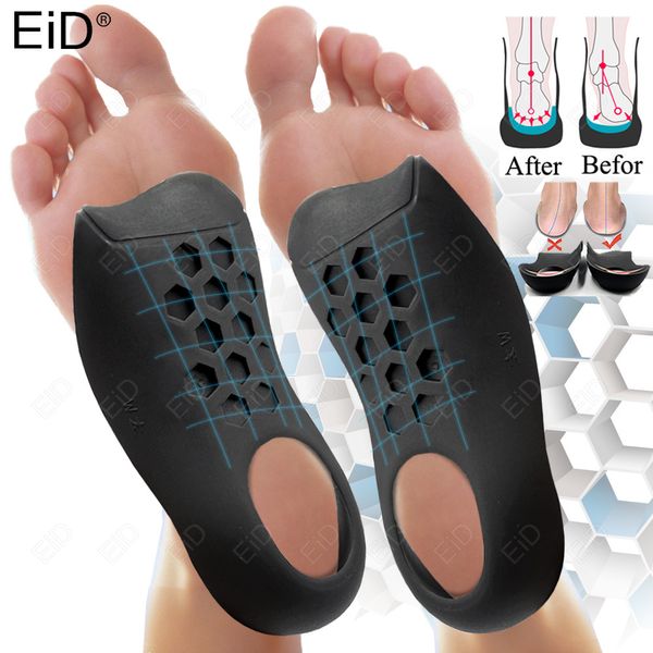 Pièces de chaussures Accessoires EiD Ort ic Semelles pour XO Jambes Correction Orthopédique Pieds Plats Talon Douleur Arch Support Pour Homme Femme Semelle Insert 230414