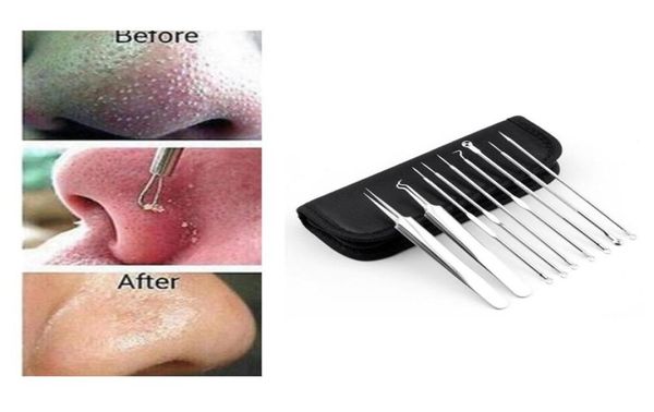 Plateado satir inoxidable hojas de negro comedone acné extractor removedor pinzapule alfilador de cuidados de belleza cosméticos