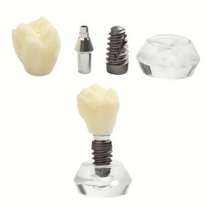 Modèle de couronne à dent unique, modèle de démonstration d'implant de dents détachables, modèle d'enseignement de la dentisterie en cristal pour les cliniques de dentistes