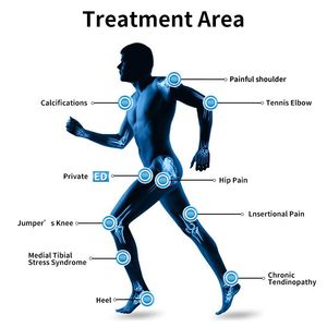 Minceur ems shockwave ed thérapie machine de traitement coût rf radiofréquence hommes qui fonctionne 3 en 1 transformateur masseur équipement de soulagement douloureux