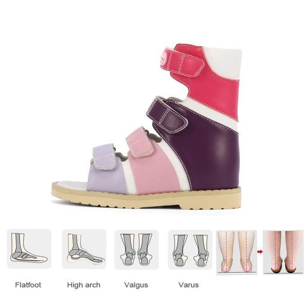 Sneakers Girls Sandals de verano Niños ortopédicos High tobillo Clubfoot zapatos Niños Niños Cute calzado de tratamiento con plantilla de soporte de arco