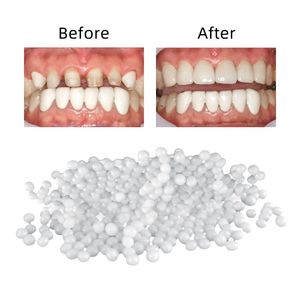 Blanqueamiento dental 100G Conjunto de reparación de dientes y brecha Falseteeth Pegamento sólido Adhesivo para dentaduras Dentista Resina Entrega temporal de gota Salud Be Dhi78