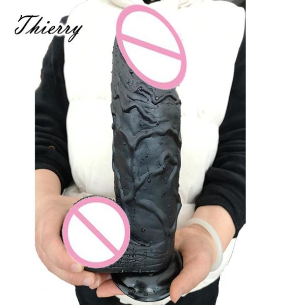 Thierry 1004287 pouces énorme gode noir épais réaliste coq grand pénis Big Dong Dick jouets sexuels pour femmes produits de sexe érotique T12497238