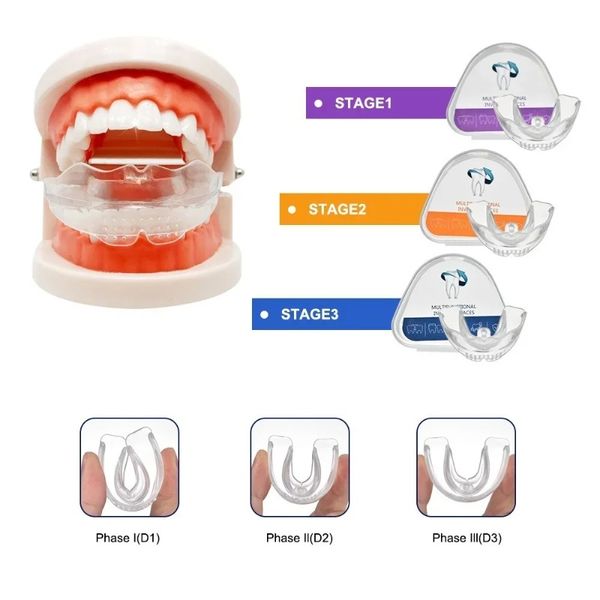 Trois étapes dents dentaires dent dent invisible redrennine orthodontique SILICONE Dental Appliance Kard Kard Kard