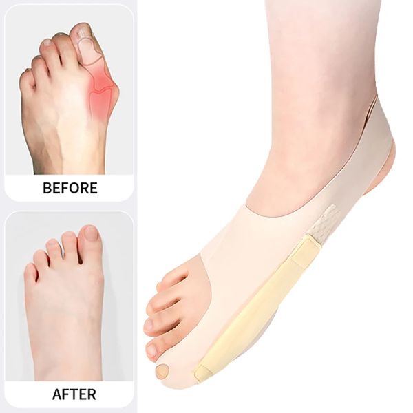 Outil 1 PCS Big Toe Protector Ajuster Unisexe Soft Pedicure Choques pour les oignons Hallux Valgus Orthopedic Bandage Foot Care Toe Correction