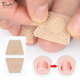 Gereedschap 2/6/12pc ingegroeide teennagel teen Correctiestickers Nail Art Foot Patches voeten zorg paronychia behandeling herstel pedicure voet gereedschap