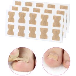 Outil 20/50 / 100pcs Correction des ongles Autocollants de correction de l'ongle Patches correcteurs de l'ongle incarné paronychia Traitement récupérer les outils de pédicure correcteurs