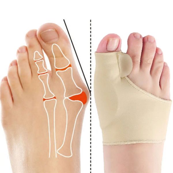 Outil 2pcs = 1pair Toe Correcteur orthotique Pied Foot Care Bos Bost Adjuct Correction Soft Pedicure chaussettes Bunion lisseur