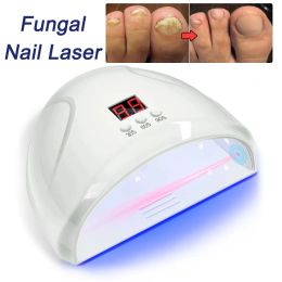 Tool Schimmel Nagel Laser Apparaat Nagels Schimmel Snelle Reparatie Onychomycose Teennagel Vingernagel Verwijdert Nagel Schimmel Voetverzorging Genezen Ingegroeide