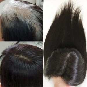 Toppers cheveux humains Base de peau droite femmes Topper 15x16 cm cuir chevelu naturel postiche Fine Clips dans les cheveux Topper pour les femmes cheveux